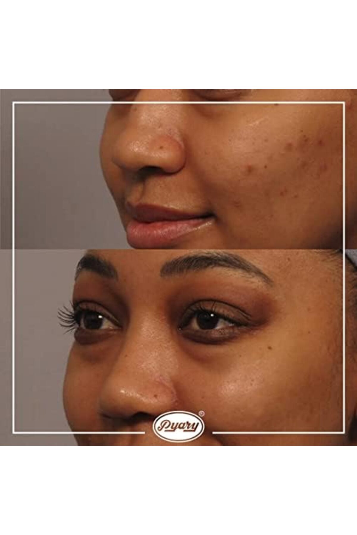 Pappaya Herbal Soap Bar 6 Pieces 135 g